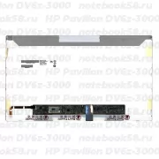 Матрица для ноутбука HP Pavilion DV6z-3000 (1366x768 HD) TN, 40pin, Глянцевая